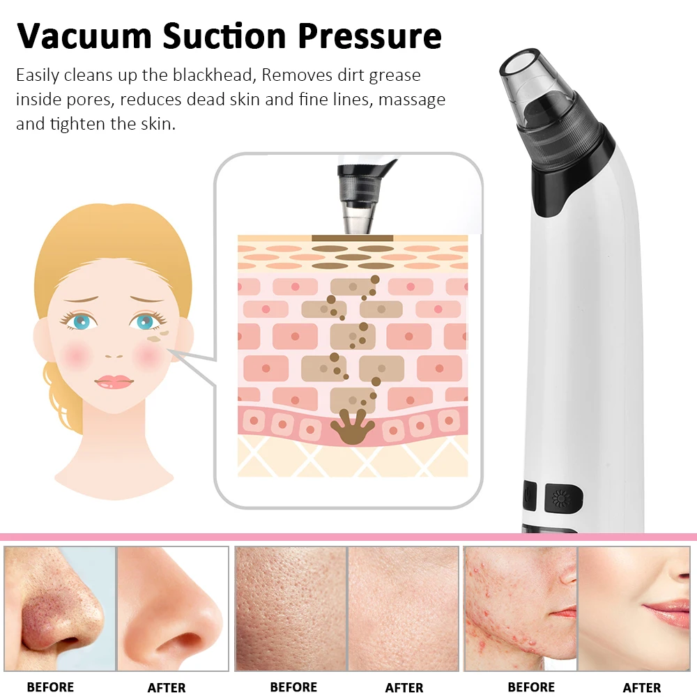 Facial pore cleanser acne remover blackhead remover Facial Cleaner Nose Blackhead Remover Deep Pore Acne Pimple Removal Vacuum Suction Diamond T Zone Beauty Tool USB Face Household
