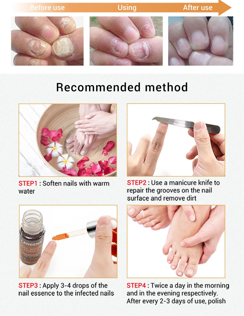 От грибка для ногтей средство для ухода за ногтями ног и ног средство для лечения против грибкового онихомикоза восстанавливающая эссенция LANBENA