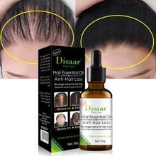 

Effective Fast Growth Hair Care Serum Moisturizing Anti-Hair Loss Scalp Repair Anti-Dry Anti-Breaking Ginger Scalp Treatment