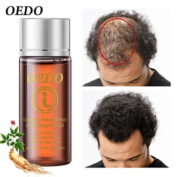 

For Men Fast Hair Growth Essence Oil Hair Loss Treatment Help For Hair Growth Serum Repair Shampoo Lador Repair Treatment Dense