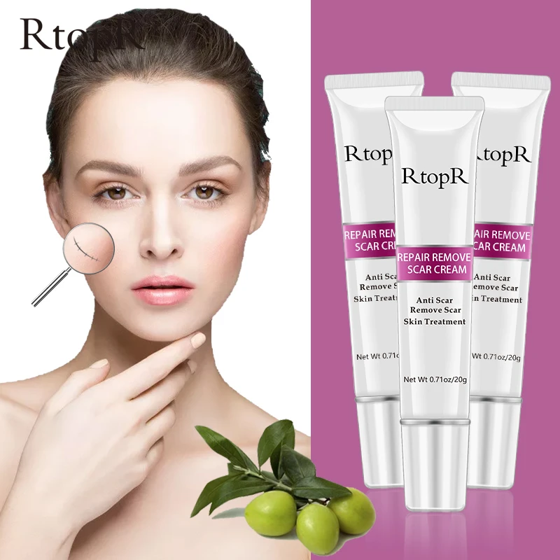 cream to remove marks on skin