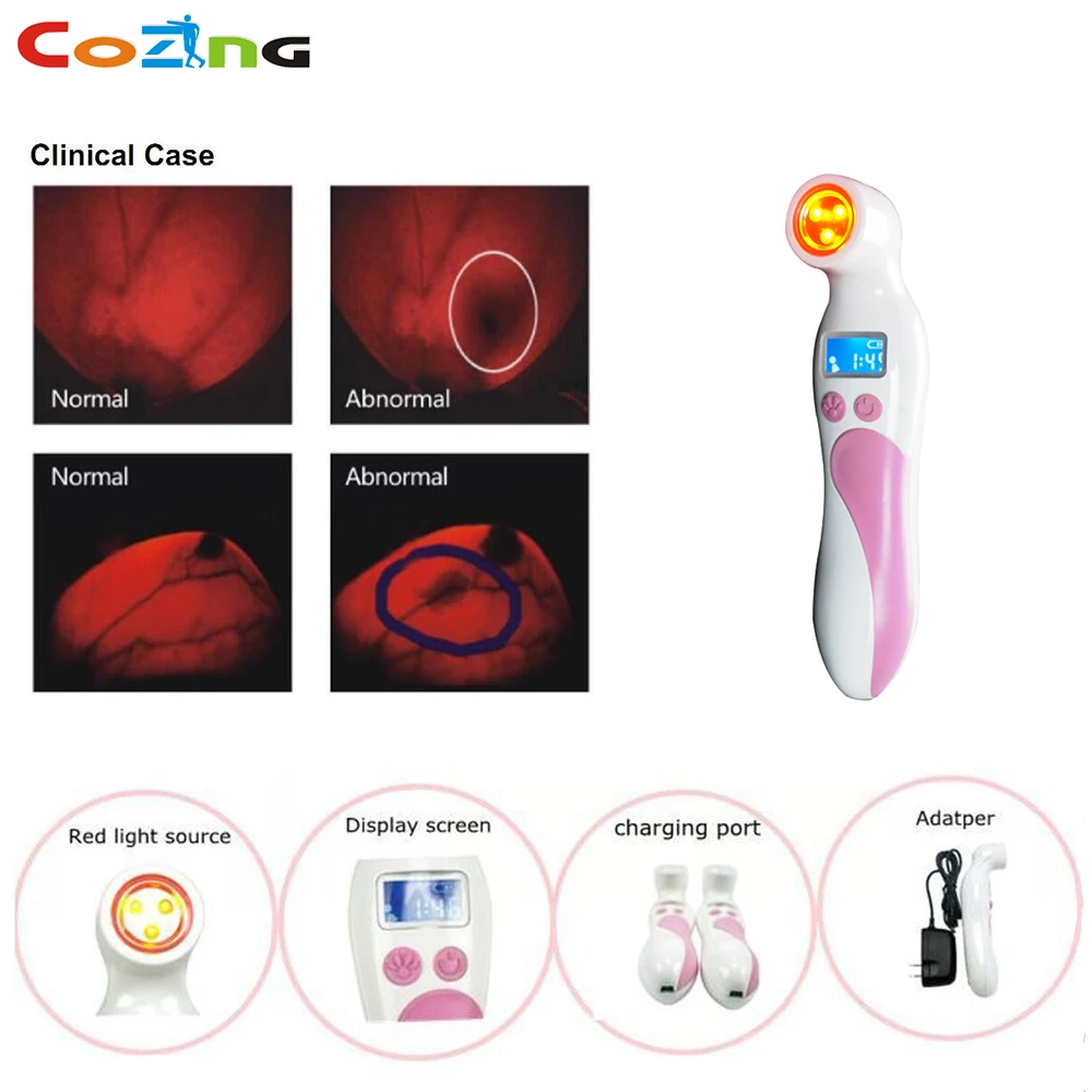 

Hot selling high accuracy medical infrared mammary inspection lamp for women home use