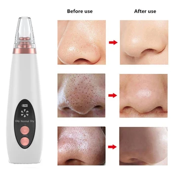 

USB Rechargeable Blackhead Remover Face Pore Vacuum Skin Care Acne Pore Cleaner Pimple Removal Vacuum Suction Facial Tools