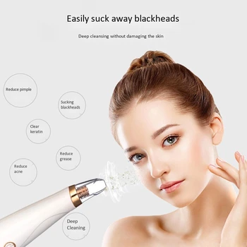 

Blackhead Remover Vacuum - Blackhead Suction Device with 3 Adjustable Suction Levels and 5 Removable Probes