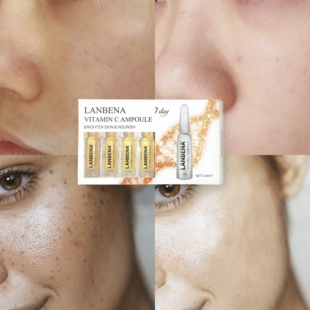 LANBENA Vitamin C Whitening Facial Serum Collagen Skin Care Face Cream Moisturizing Anti-Aging Sheet Mask Essence Remove Freckle LANBENA Vitamin C Whitening Facial Serum Collagen Skin Care Face Cream Moisturizing Anti-Aging Sheet Mask Essence Remove Freckle