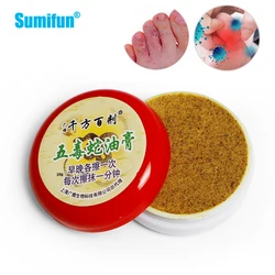 1pc 20g Chinese Herbal Antibacterial Foot Berriberi Cream Anti Fungal Infection Ointment Anti-Itch Odor Peeling Foot Health Care