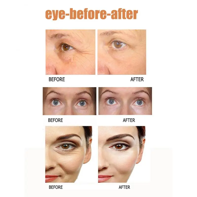 Remove Dark Circles Eye Care Essence Smooth Fine Lines Against Aging Moisturizer Eye Cream Eye Bag Remover Eye Essence Oil Tslm1