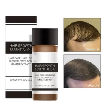 

LANBENA 20ml Powerful Hair Growth Essence Oil Preventing Loss Nourish Liquid Drop the essence in palm to m-ix it with shampoo