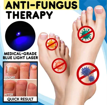

Anti-fungal Home Treatment Set Toe Nail Treatment Pen Onychomycosis Paronychia Anti Fungal Fungus Care Repair Serum Kit