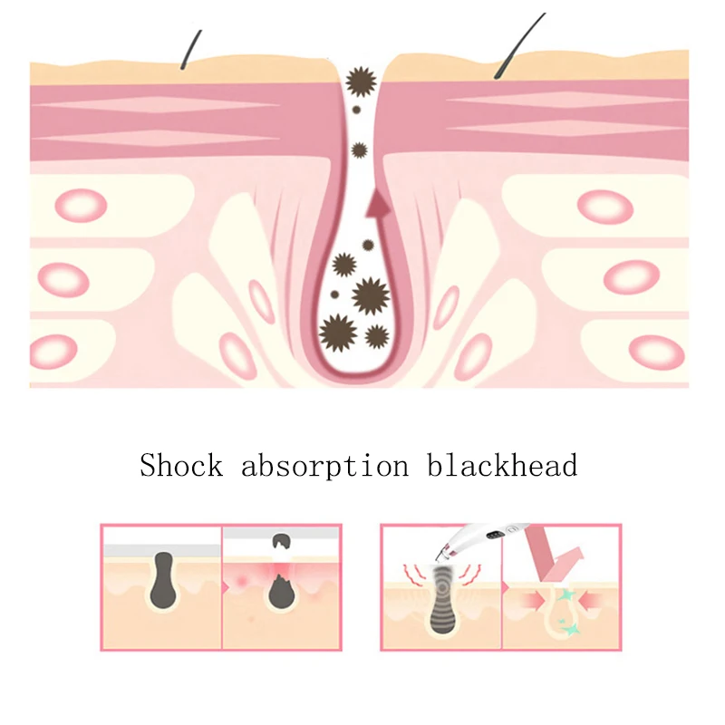 Пылесос для всасывания пор, аппарат для ухода за кожей лица, средство для удаления черных точек, средство для удаления прыщей