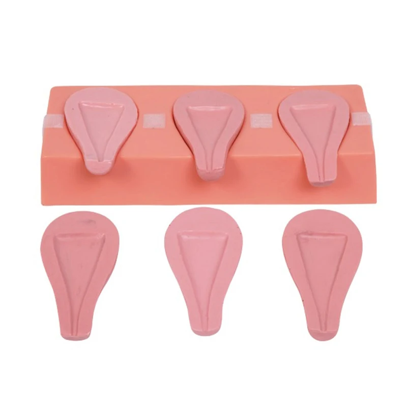 T33A uterus