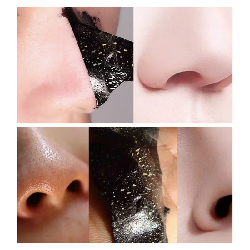 TF0035 (4)