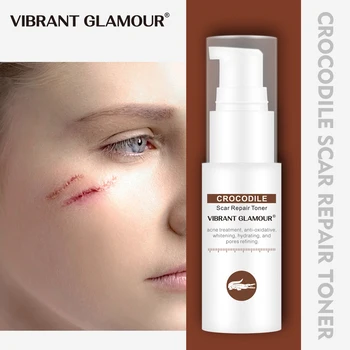 

VIBRANT GLAMOUR Crocodile Face Toner Repair Scar Essence Removal Acne Scar Marks Pigmentation Corrector Scalded Scar Body Care