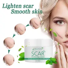 

10ml/20ml/30ml/50ml Scar Cream Quick Absorption Penetrate Natural Extract Plant Acne Stretch Mark Remover Burn Cream for Female