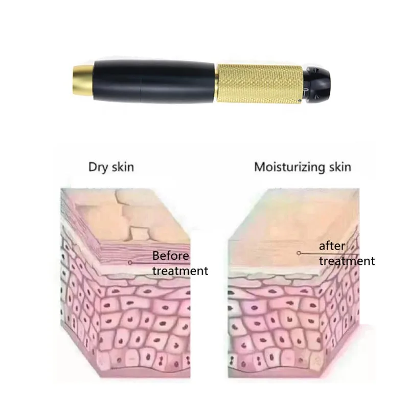 0,5 чистая гиалуроновая ручка 3-скоростной давления Мезотерапия пистолет распылитель гиалуроновой stift ручка для губ дермального филлера инжектор анти-морщинки пистолет