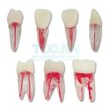 2PCS Dental Endodontic Tooth Model With Colored Root Canal And Pulp Model Dentist Tools For Student Study Practice