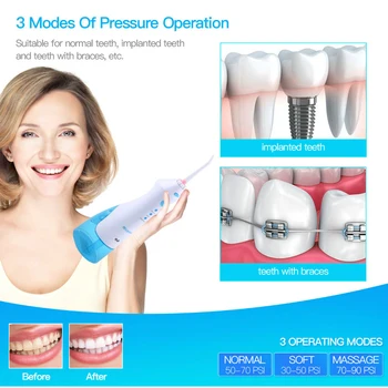 

irrigator Water Dental Flosser Professional Rechargeable Waterpick Irrigation Water Jet Toothbrush with 2 tip