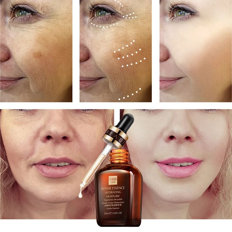 SENANA Advance Repair эссенция для лица антивозрастной увлажняющий отбеливающий против морщин удаление акне сужение пор укрепляющий уход за лицом