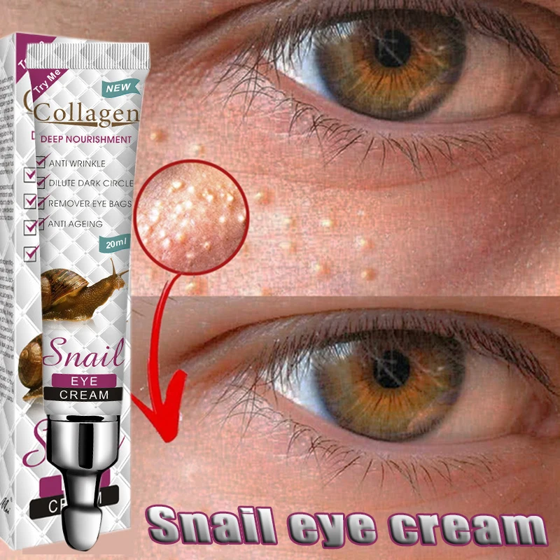 20ml Snail Firming Eye Cream For Dark Circles & Wrinkles & Fat Granule