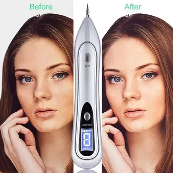 

9 Level LCD Wart Mole Removal Pen Laser Tattoo Mole Dark Tag Freckle Wart Colors Machine 7 Care Removal Spot Face Removal S N3G9