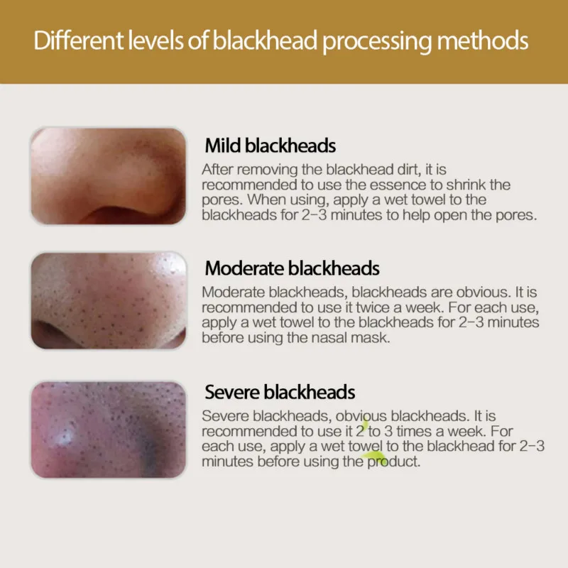 stratum corneum blackhead removal