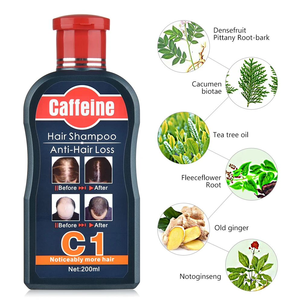 Amazon.com: Caffeine Hair Loss Hair Growth Shampoo, Volumizing Thinning Hair  with Natural and Healthy Ingredients : Beauty & Personal Care