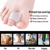 2pcs Toe Separator Insoles Ring Separation Hallux Valgus Correction Pad Foot Care Orthopedic Foot Toe Hallux Valgus Correct ► Photo 3/6