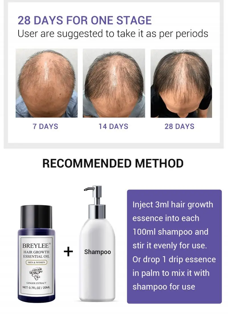 20ml Hair Fast Growth Essential Oil Treatment Anti-Hair Loss Serum  Nourishing Hair Care Essential Oil Hair Loss Product - AliExpress