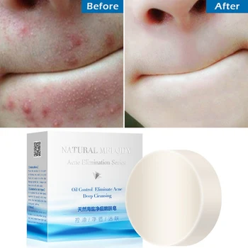 

100g Natural Sea Salt Soap Anti-acnes Anti-mite Nourishing Moisturizing Skin Oil-control Handmade Soap