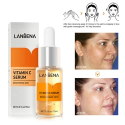 LANBENA Face Serum Vitamin C Hyaluronic Acid Essence Anti-Aging Winkles Whitening Blackhead Removing Moisturizing Skin Care