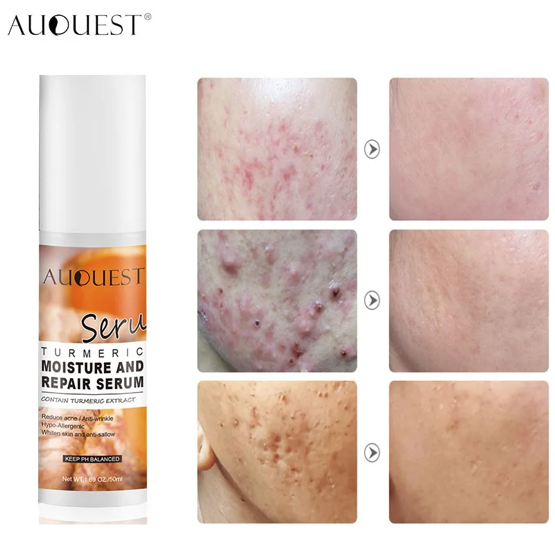 

AUQUEST Turmeric Collagen Face Serum 50ml Acne Treatment Whitening Moisturizing Repair Anti-wrinkle Shrink Pores Face Skin Care