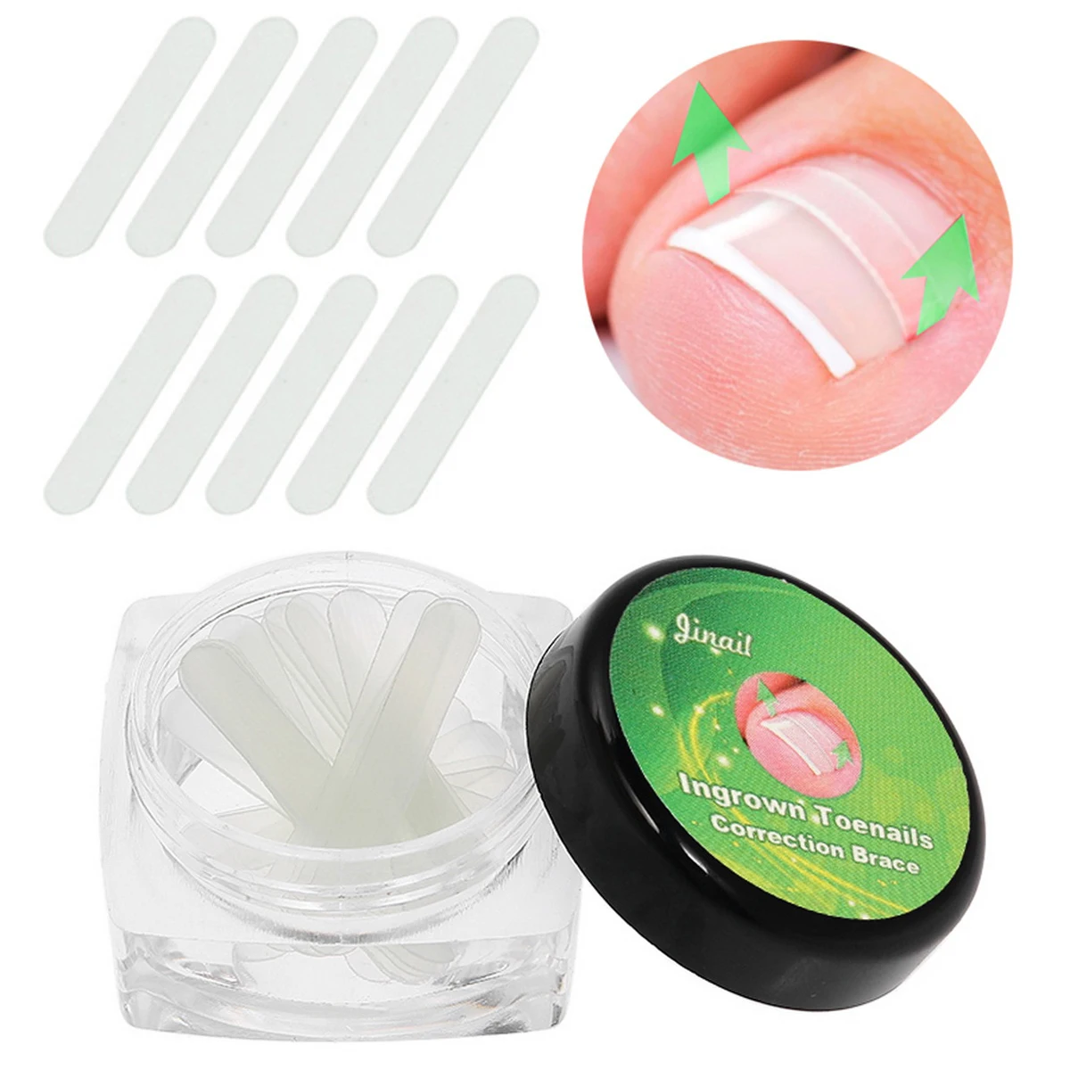 

Ingrown Toe Nail Correction Sticker Patch Paronychia Corrector File Elastic Patch Corrector Foot Care Treatment Pedicure Box