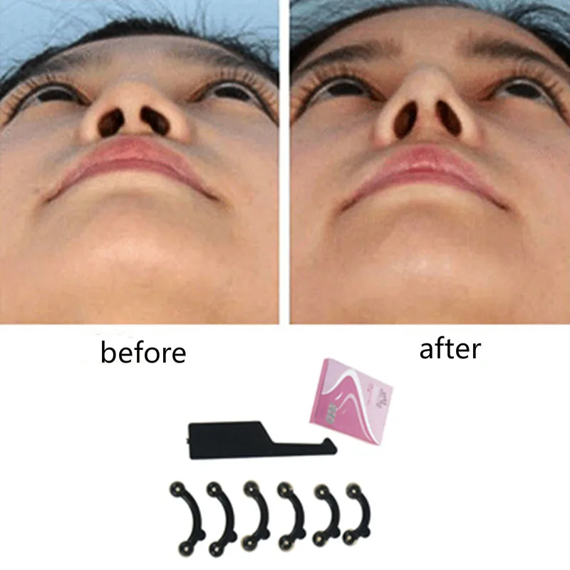 Pince cosmétique pour le redressement de l'arête du nez R6W7 