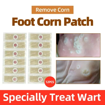 

12/24/36/48PC Foot Corn Removal Warts stickers Toe Thorn Pain Relief Patch Meat Thorn Warts Medical Plaster Skin Removal Warts
