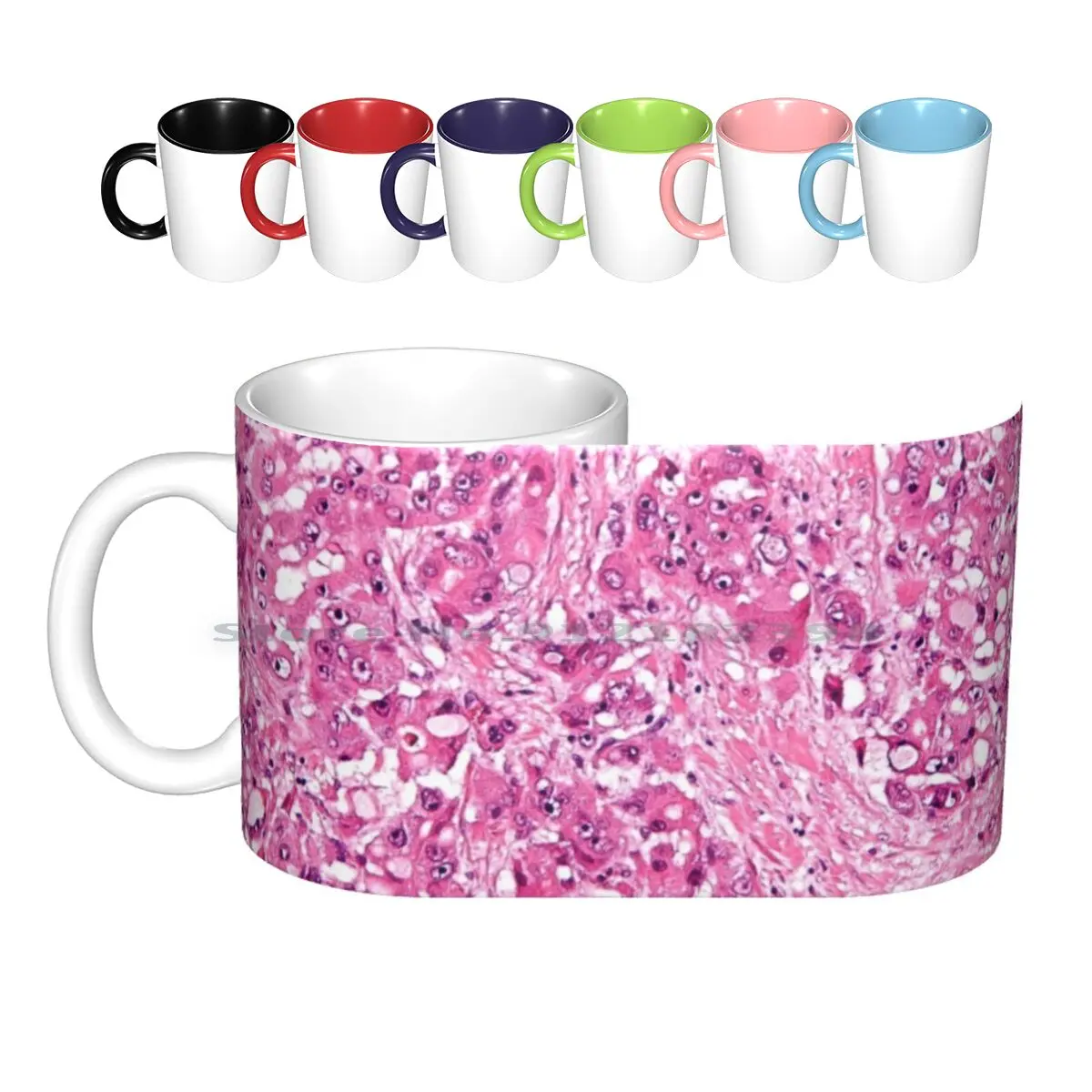 Liver-Cancer-Histology-Ceramic-Mugs-Coffee-Cups-Milk-Tea-Mug-Histology ...