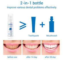 Отбеливающий мусс для отбеливания зубов гигиеническая зубная паста для полости рта удаление пятен удаление желтых зубов стоматологические инструменты