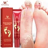 Foot Care Cream Foot spa Pedicure Herbal Detox Anti Fungal Infection Onychomycosis Fungus Treatment   For legs ► Photo 1/6