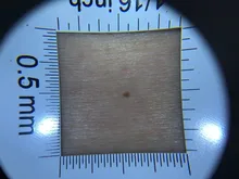 Lupa con mango de dermatoscopio 10X, visión clara suave con escala de medida, 30X, tipo B, visión más grande con luz UV