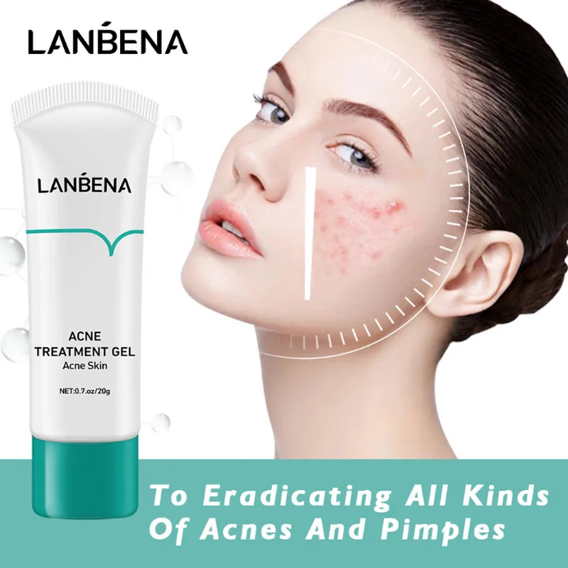 LANBENA Acne Treatment Face Cream Anti Facial Gel Scar Pimple Removal Oil Control Fading Marks Scars Repair Skin Care | Красота и