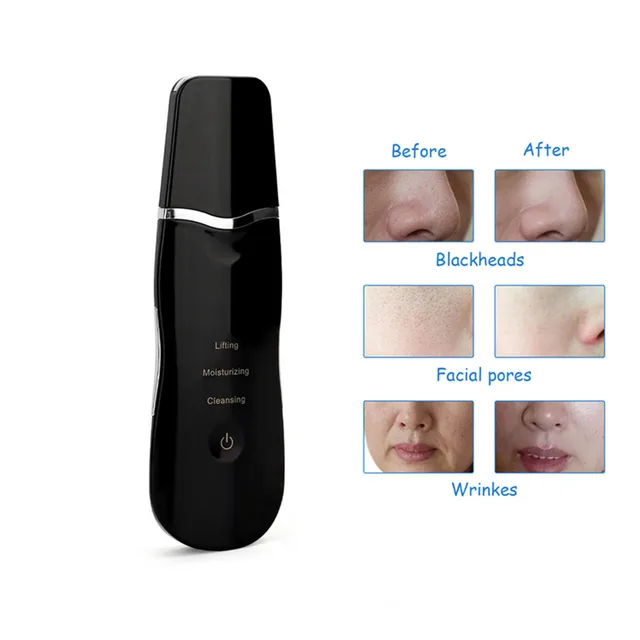 $US $21.23  Ultrasonic Ion Facial Deep Cleaner Blackhead Acne Remover Facial Exfoliator Skin Scrubber Peeling S