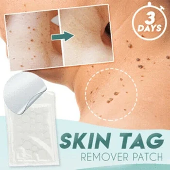 

Skin Tag and Acne Master Patch Sticker Face Facial Skin Care Cover Safe Beauty Hydrocolloid Acne Invisible Pimple Master Patch