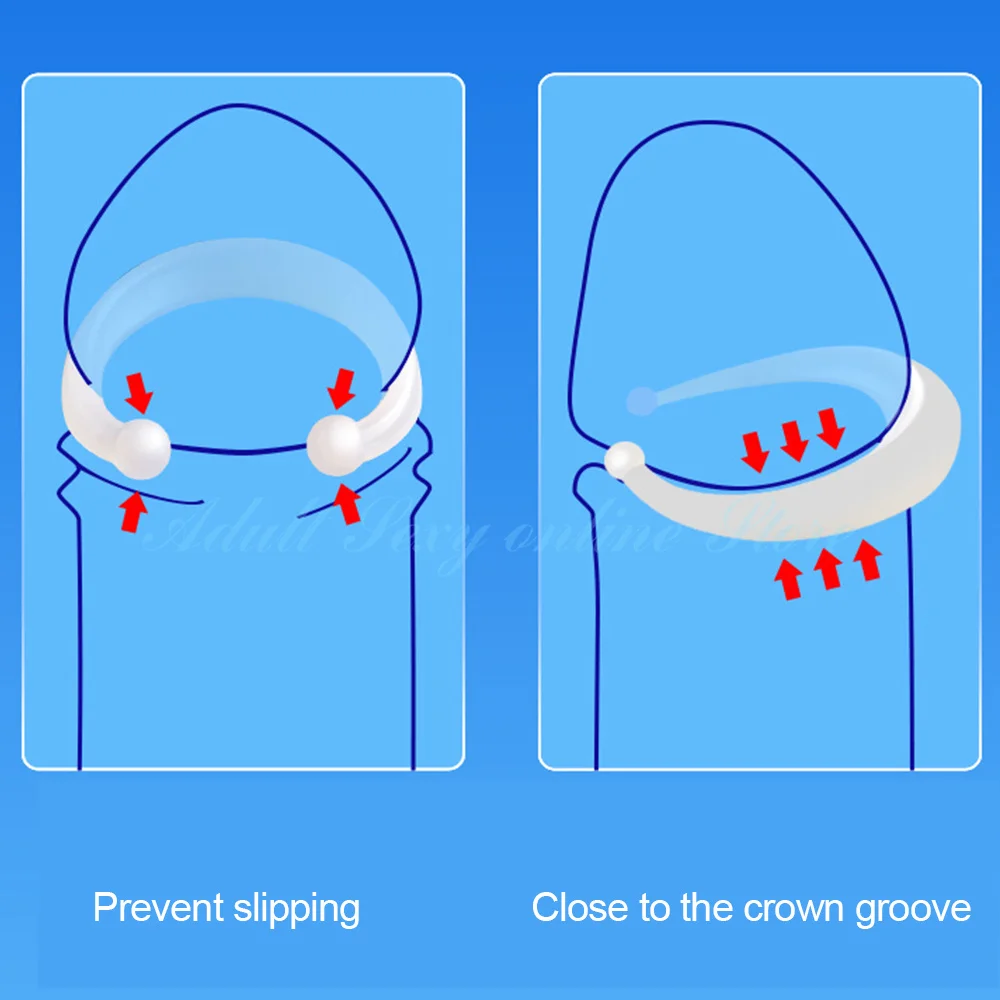 Foreskin Corrector Cock Ring Penis Stretcher Resistance Ring Sex Toys 2PCS/Set male sex toys for Men