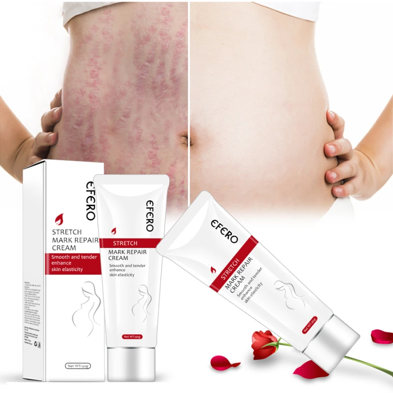 

Efero Stretch Marks Remover Scar Removal Powerful Postpartum Obesity Pregnancy Cream Anti-Aging Anti Winkles Firming Body TSLM1