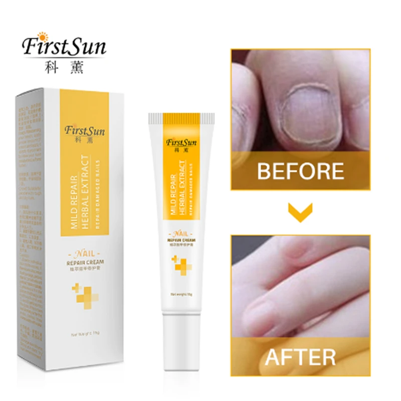 Firstsun носок против грибка для ногтей Лечение травяной крем Onychomycosis Paronychia Лечение ногтей Podiatry ремонт