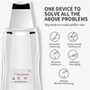 Deeply ultrasonic face skin pore cleaner device blackhead removal Device Peeling shovel exfoliator deeply clean the skin ► Photo 2/5