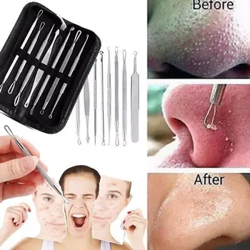 

7Pcs Pro Blackhead Acne Pimple Blemish Remover Comedone Extractor Tweezers Kit Remover Makeup Tool With Leather Case