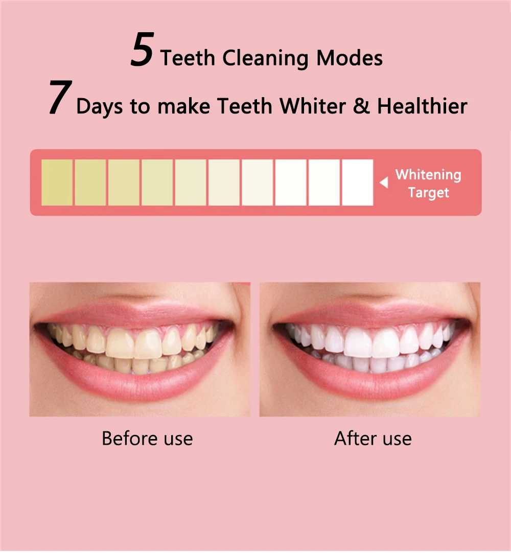 Electric Toothbrush (4)