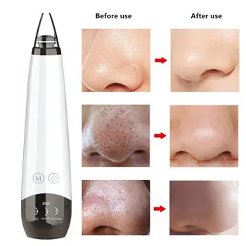 

Bakeey Electric 3 Levels 6 Replacement Heads Vacuum Deep Removal Pore Blackhead Remover Acne Beauty Instrument