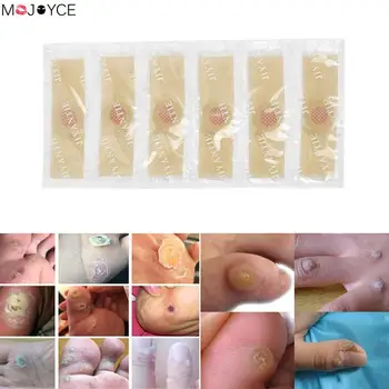 

12pcs/set Foot Care Stickers Medical Plaster Chicken Eye Corns Patches Medical Plaster Foot Corn Removal