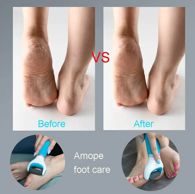 Electric Foot File Grinder Dead Skin Callus Remover for Foot Pedicure Tools Feet Care for Hard Cracked Foot Files Clean Tools bl 5